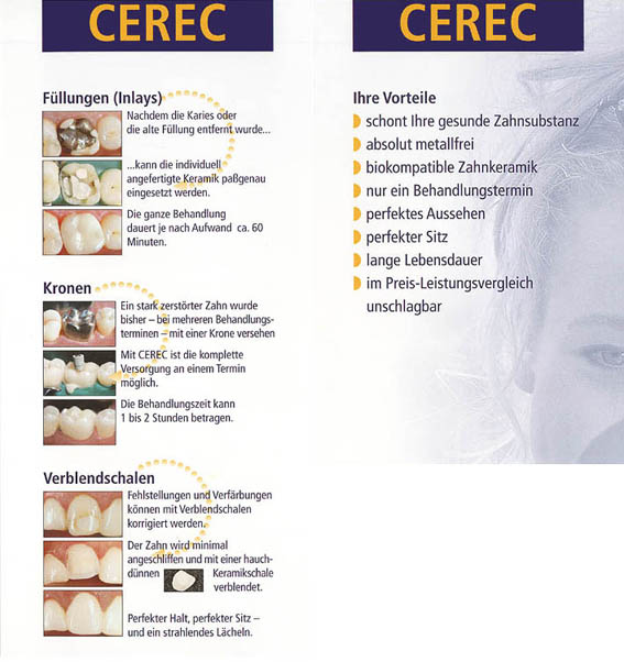 Cerec Dormagen